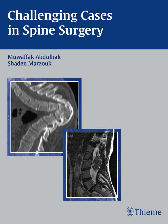 Challenging Cases in Spine Surgery.jpg