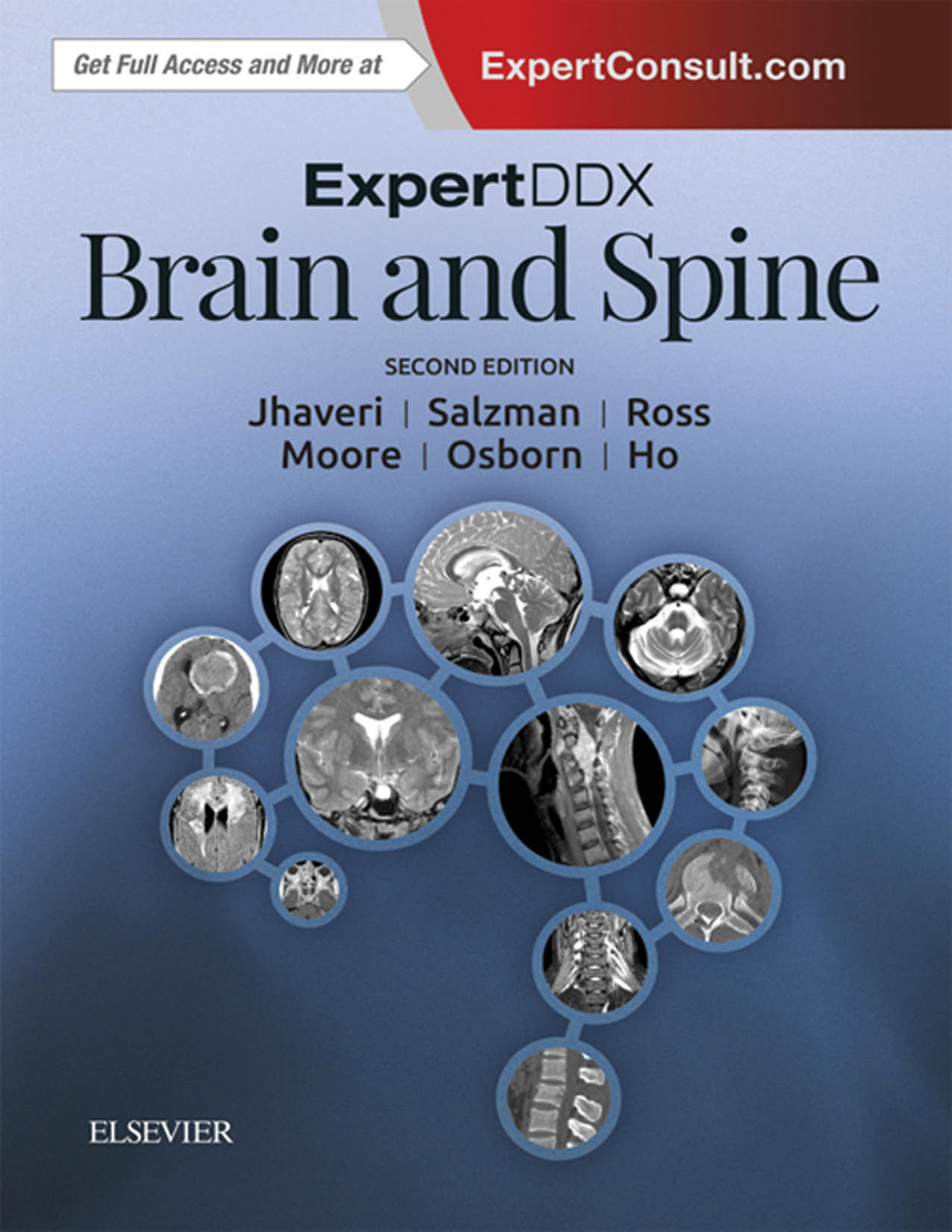 页面提取自－[lib99.net]_ExpertDDx Brain and Spine E-Book-old.jpg