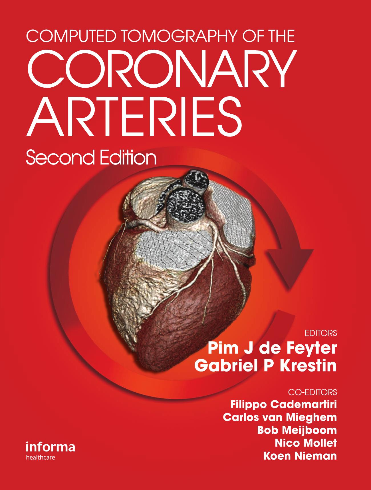 Computed Tomography of the Coronary Arteries.jpg