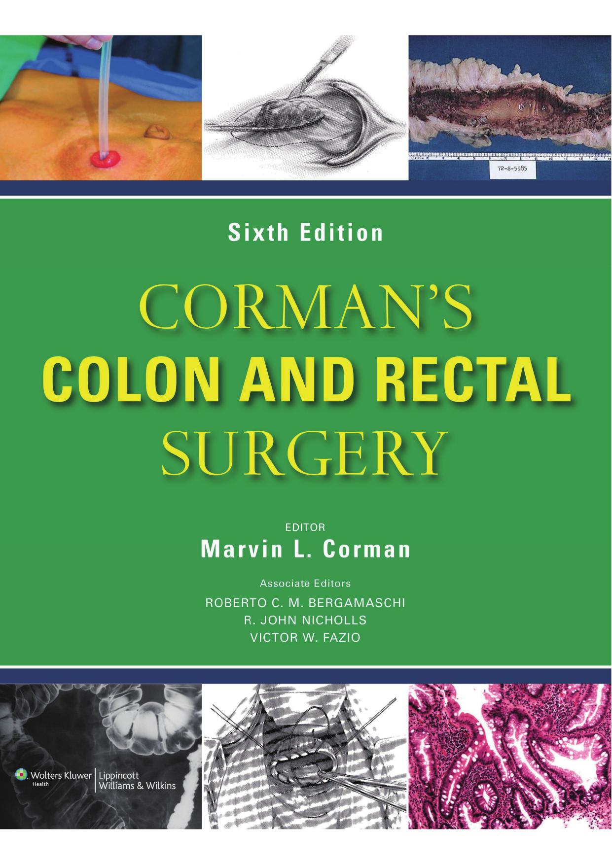 Corman's Colon and Rectal Surgery,6th Edition.jpg
