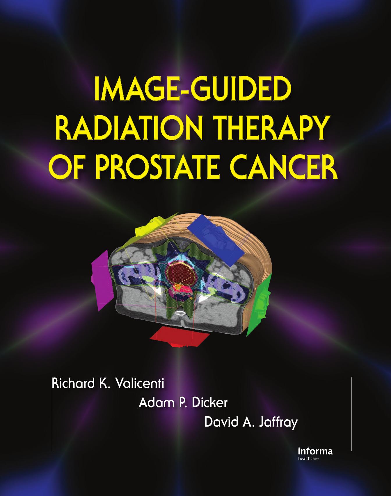 Image-Guided Radiation Therapy of Prostate Cancer.jpg