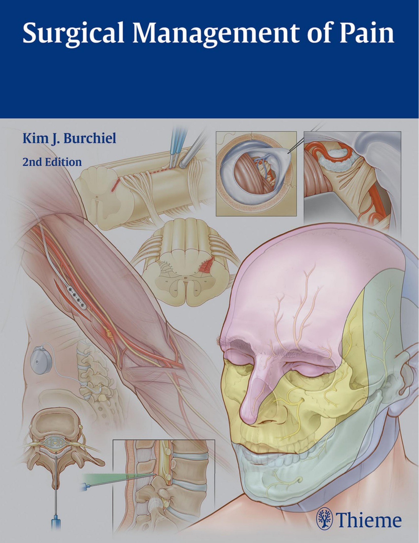 Surgical Management of Pain,2nd Edition.jpg