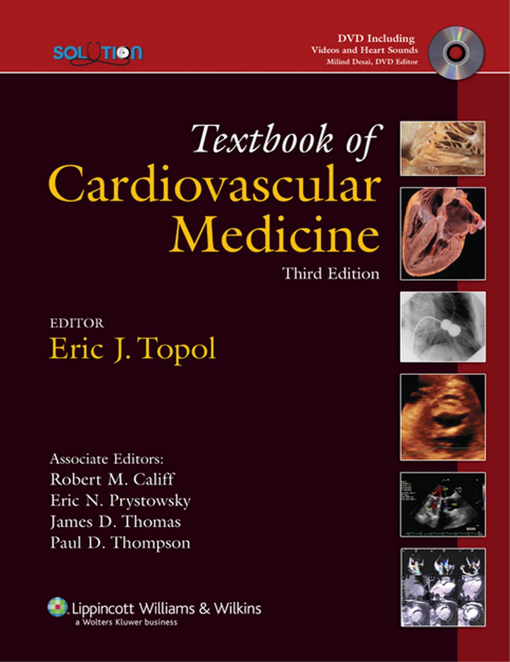 Topol Solution Textbook of Cardiovascular Medicine, 3rd Edition - Wei Zhi.jpg