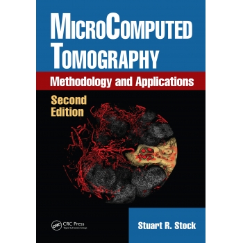 MicroComputed Tomography Methodology and Applications, Second Edition