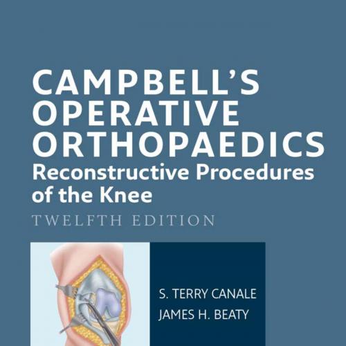 Campbell's Operative Orthopaedics Reconstructive Procedures of the Knee, 12th Edition