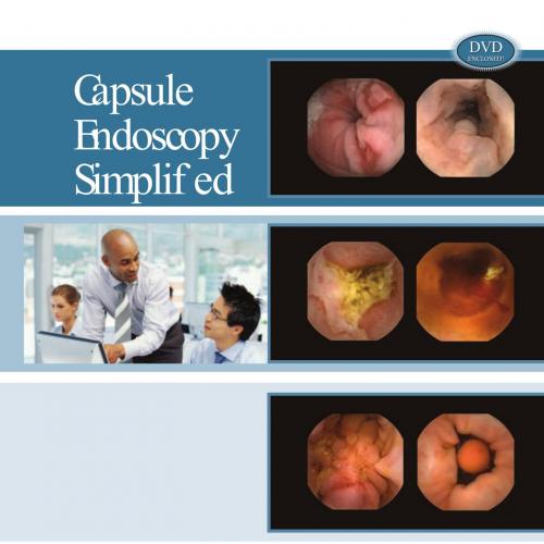 Capsule Endoscopy Simplified