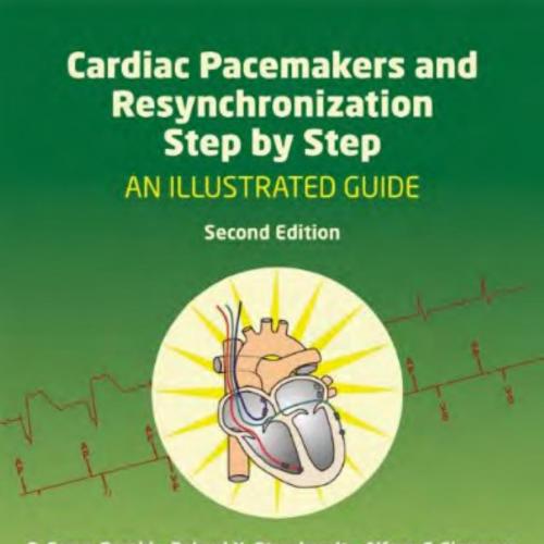 Cardiac Pacemakers and Resynchronization Step by Step-An Illustrated Guide,2e