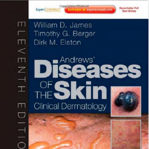 Andrews' Diseases of the Skin-Clinical Dermatology,11th Edition - William James