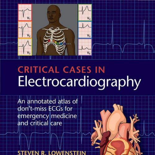 Critical Cases in Electrocardiography - Wei Zhi