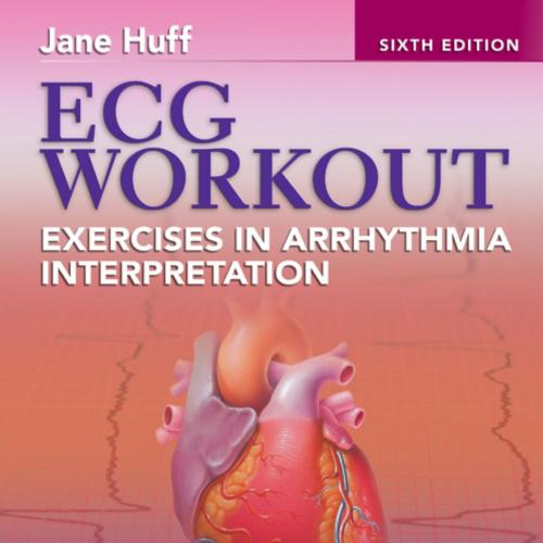 ECG Workout-Exercises in Arrhythmia Interpretation,6th Edition - PG2284