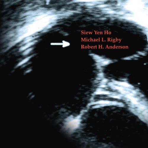 Echocardiography in Congenital Heart Disease Made Simple (258 pages) - Siew Yen Ho, Michael L. Rigby & Robert H. Anderson