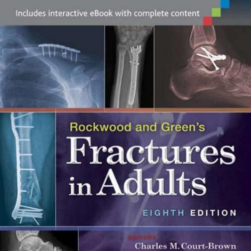 Rockwood and Green's Fractures in Adults,8th Edition