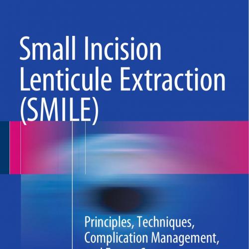 Small Incision Lenticule Extraction (SMILE) Principles, Techniques, Complication Management, and Future Concepts 1st