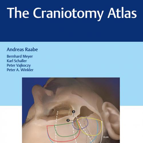 Thieme_ The Craniotomy Atlas