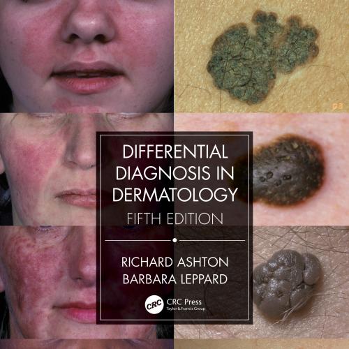 Differential Diagnosis in Dermatology 5th Edition