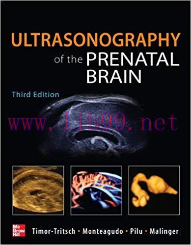 (PDF)Ultrasonography of the Prenatal Brain, Third Edition 3rd Edition