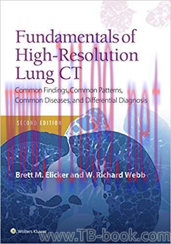 Fundamentals of High-Resolution Lung CT: Common Findings, Common Patterns, Common Diseases and Differential Diagnosis 2nd Edition by Brett M. Elicker
