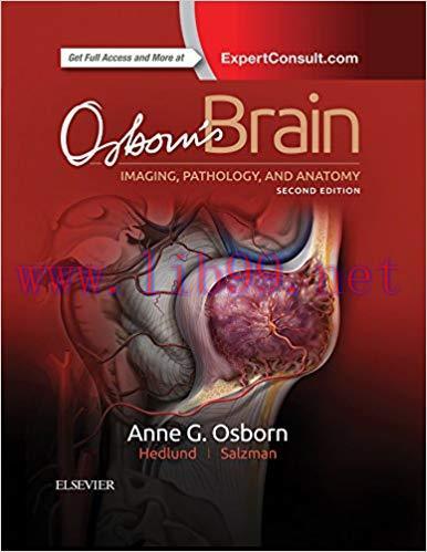 (PDF)Osborn’s Brain E-Book 2nd Edition