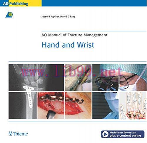 (PDF)AO Manual of Fracture Management: Hand & Wrist (AO Manual of Fracture Management Series)