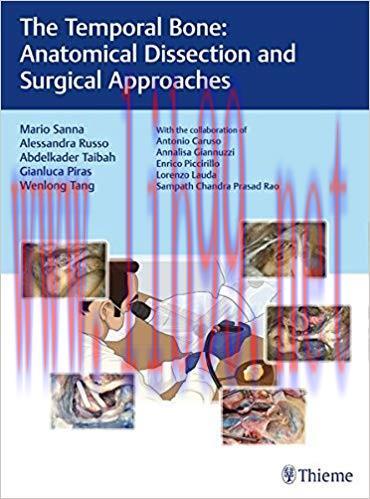 [PDF]The Temporal Bone: Anatomical Dissection and Surgical Approaches