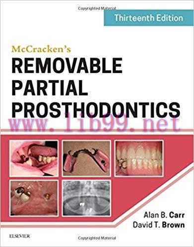 [PDF]McCracken’s Removable Partial Prosthodontics 13th