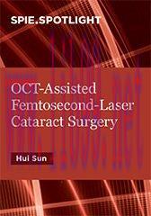 [PDF]OCT-Assisted Femtosecond Laser Cataract Surgery
