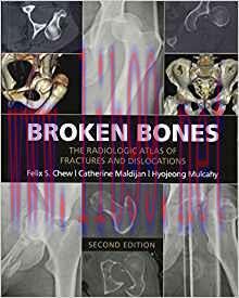[PDF]Broken Bones - The Radiologic Atlas of Fractures and Dislocations 2nd Edition