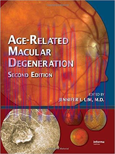 [PDF]Age-Related Macular Degeneration, Second Edition [LWW]
