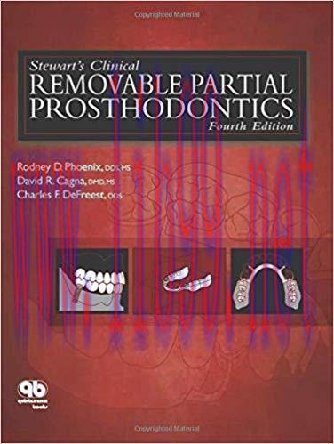 [PDF]Stewart’s Clinical Removable Partial Prosthodontics 4th Edition