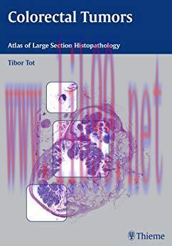 [PDF]Colorectal Tumors Atlas of Large Section Histopathology, 1e [Thieme] [2005]