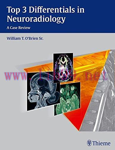 [FOX-Ebook]Top 3 Differentials in Neuroradiology