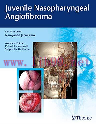 [AME]Juvenile Nasopharyngeal Angiofibroma (Original PDF)