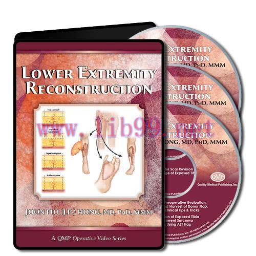 [AME]Lower Extremity Reconstruction (CME VIDEOS)