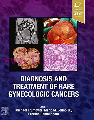 [AME]Diagnosis and Treatment of Rare Gynecologic Cancers (True PDF)