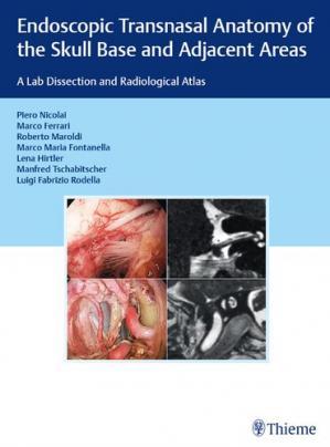 [AME]Endoscopic Transnasal Anatomy of the Skull Base and Adjacent Areas: A Lab Dissection and Radiological Atlas (EPUB)