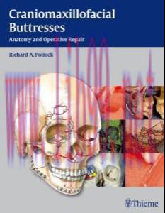 [AME]Craniomaxillofacial Buttresses: Anatomy and Operative Repair (Original PDF)