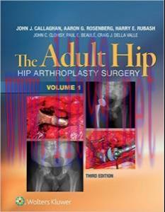 [AME]The Adult Hip (Two Volume Set): Hip Arthroplasty Surgery, Third Edition (EPUB)
