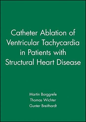 Catheter Ablation of Ventricular Tachycardia in Patients with Structural Heart Disease,volume 13 1st Edition