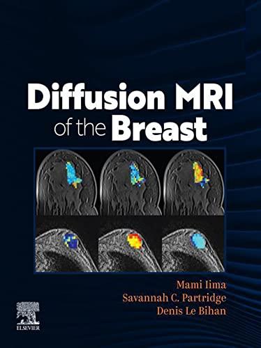 [PDF]Diffusion MRI of the Breast 1st Edition