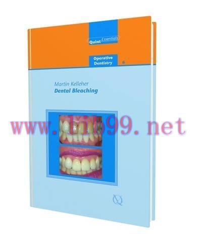 [AME]Dental Bleaching (Quintessentials of Dental Practice: Operative Dentistry 6) (EPUB) 