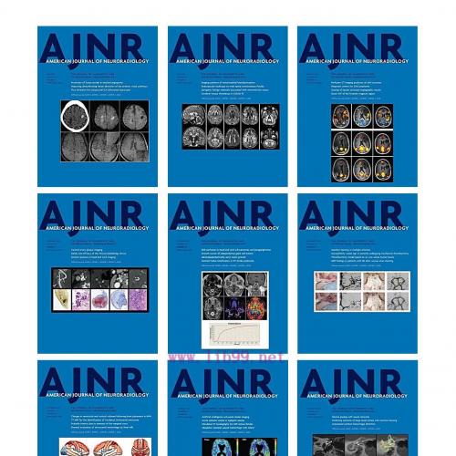 [AME]American journal of Neuroradiology 2021 Full Archives (True PDF) 
