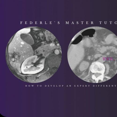 [AME]Federle’s Master Tutorial on Abdominal Imaging: How to Develop an Expert Differential Diagnosis using Decision-Support Tools 2021 (CME VIDEOS) 