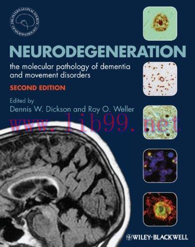 [AME]Neurodegeneration: The Molecular Pathology of Dementia and Movement Disorders, 2e (Original PDF) 