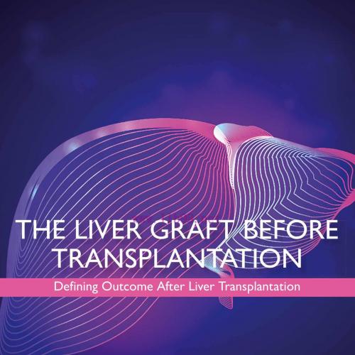 [AME]The Liver Graft Before Transplantation: Defining Outcome After Liver Transplantation (EPUB) 