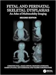 [AME]Fetal and Perinatal Skeletal Dysplasias: An Atlas of Multimodality Imaging 2e (Original PDF) 