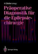[PDF]Präoperative Diagnostik für die Epilepsiechirurgie