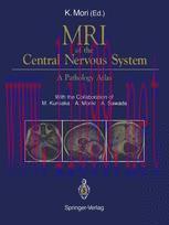 [PDF]MRI of the Central Nervous System: A Pathology Atlas