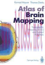 [PDF]Atlas of Brain Mapping: Topographic Mapping of EEG and Evoked Potentials