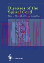 [PDF]Diseases of the Spinal Cord