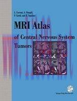 [PDF]MRI Atlas of Central Nervous System Tumors